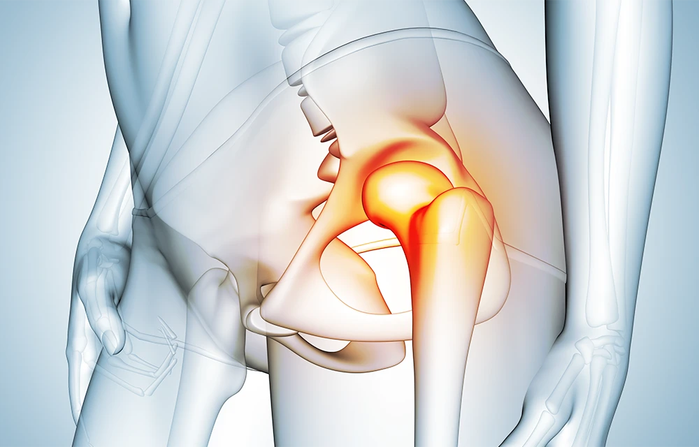 Hormoncoaching Dr. Judith Knöchel – Behandlung Osteopenie Osteoporose